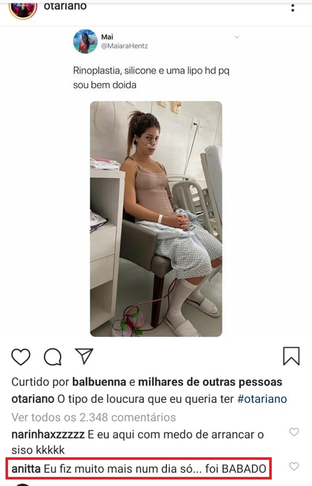 Anitta diz que já fez muito mais do que três cirurgias plásticas em um único dia (Foto: Reprodução/Instagram)