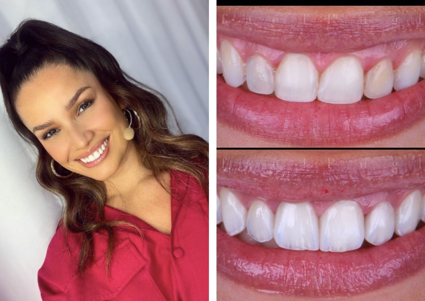 Juliette Freire coloca lentes de contato nos dentes - Revista Glamour | Celebridades