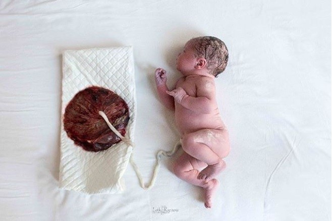Bebê conectado à placenta depois de parto de lótus (Foto: Instagram/@lobkekoppensgeboortefotografie )