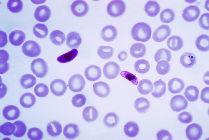 o protozoário causador da malária, o Plasmodium falciparum (Foto: Wikipedia Commons)