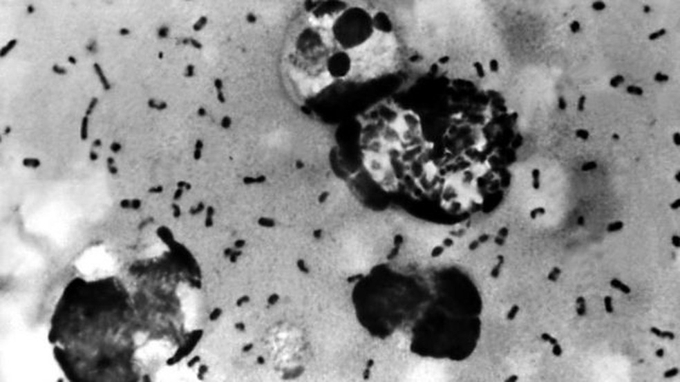 A bactéria 'Yersinia pestis' é a causadora da peste bubônica — Foto: Getty Images via BBC