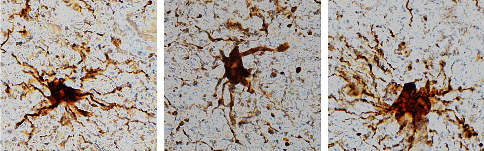 Expressão de genes zumbis em células cerebrais aumenta após a morte (Foto: Dr. Jeffrey Loeb/UIC)