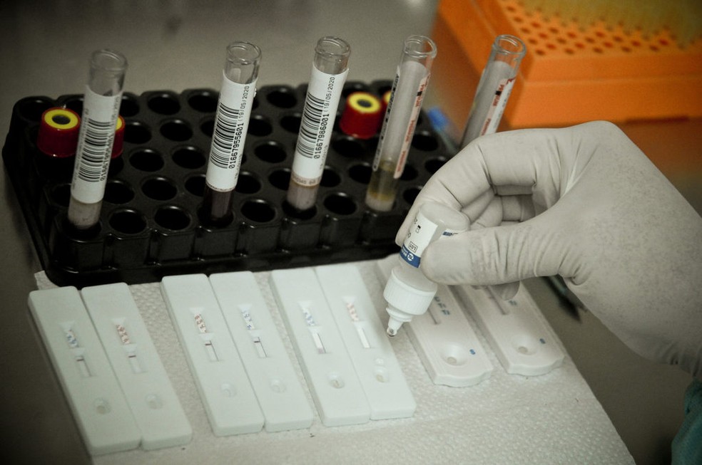 Teste do novo coronavírus é feito no Distrito Federal — Foto: Breno Esaki/Saúde-DF