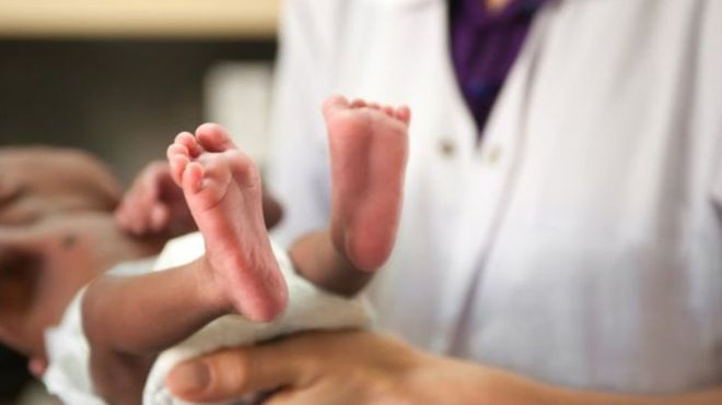 O tipo mais grave de AME geralmente causa a morte do paciente antes dos dois anos de idade (Foto: Getty Images via BBC News Brasil)