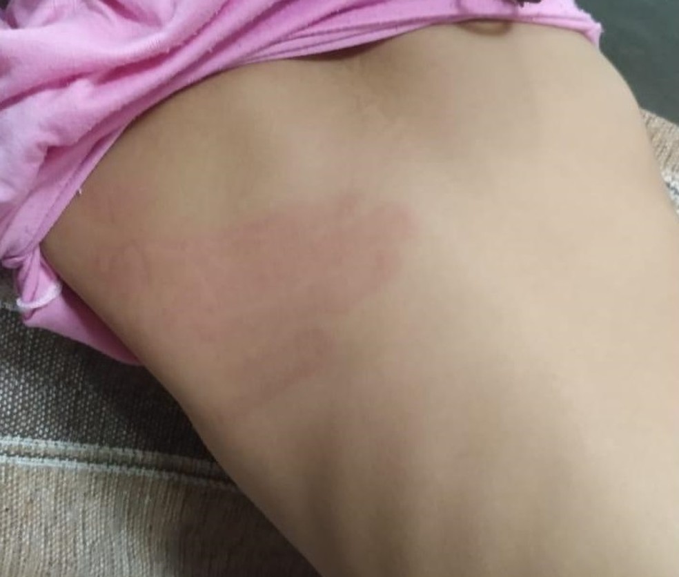 Criança agredida por tapa nas costas, no DF — Foto: PCDF/Divulgação
