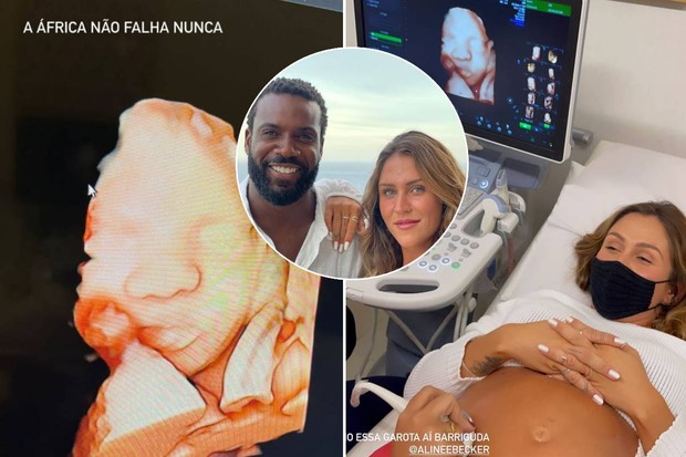 Rafael Zulu mostra ultrassom do filho que espera com Aline Becker (Foto: Reprodução/Instagram)