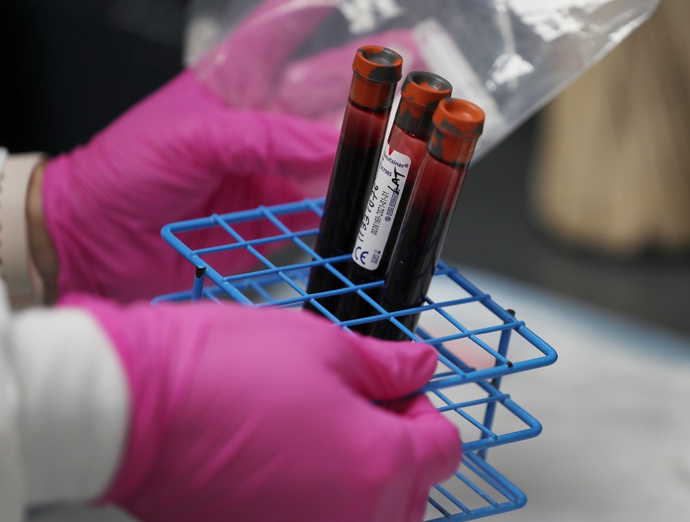 Amostras de sangue de pacientes são vistas em um teste de vacinas contra a Covid-19 na Flórida no dia 7 de agosto. — Foto: Joe Raedle/Getty Images/AFP