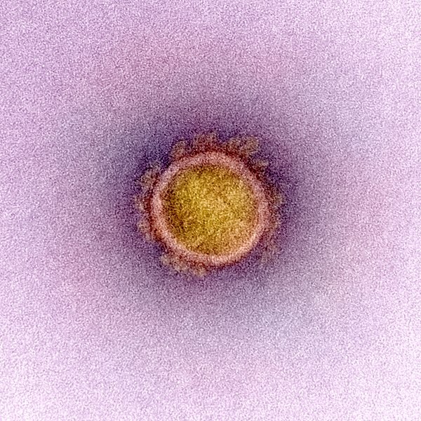 Nova versão do coronavírus está no radar do órgão quanto à transmissibilidade e à resistência a anticorpos (Foto: National Institute of Allergy and Infectious Diseases (NIAID))