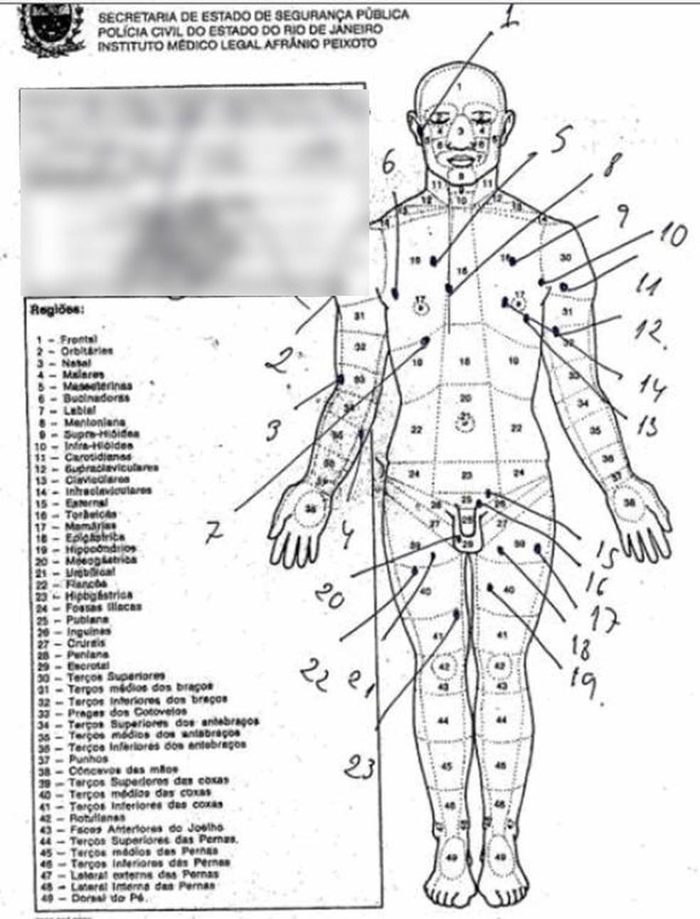 Laudo mostra que corpo de pastor Anderson tem 30 marcas de tiros — Foto: Reprodução