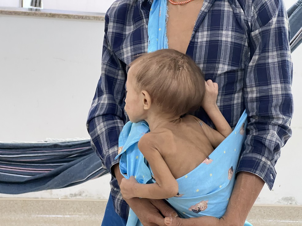 Meninia Yanomami foi internada com desnutrição grave e se recupera em Boa Vista — Foto: Caíque Rodrigues/g1 RR
