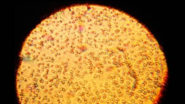 Imagem microscópica de uma amostra de leite materno humano (Foto: GETTY IMAGES (via BBC))