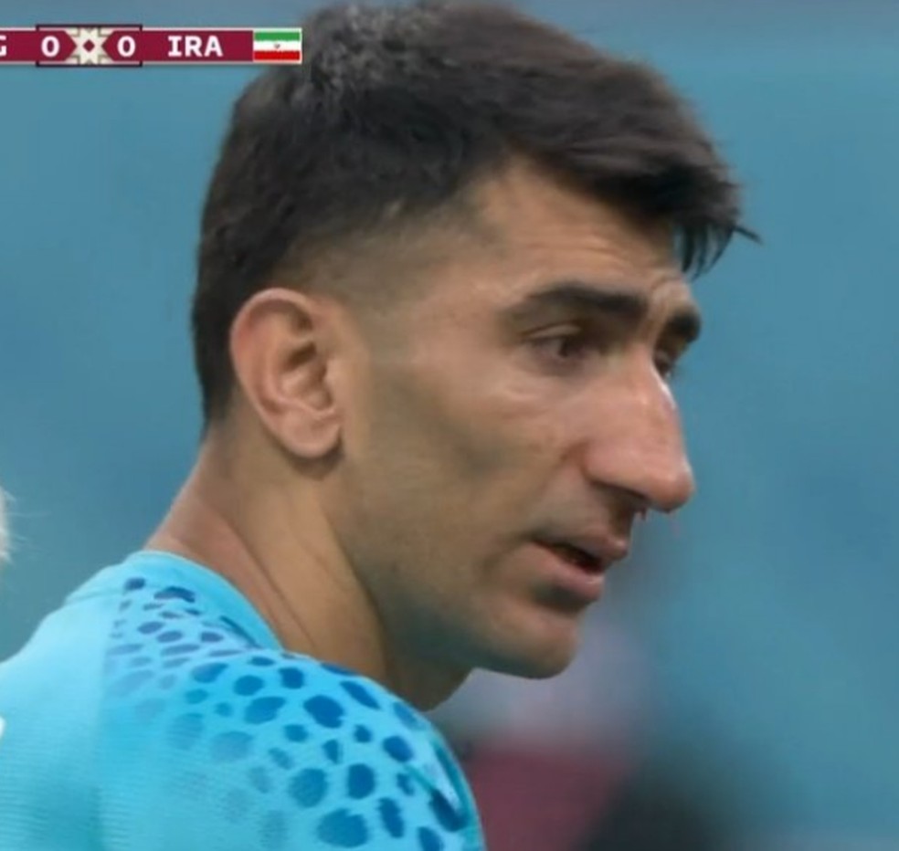 Goleiro do Ir vira meme depois de ter nariz 