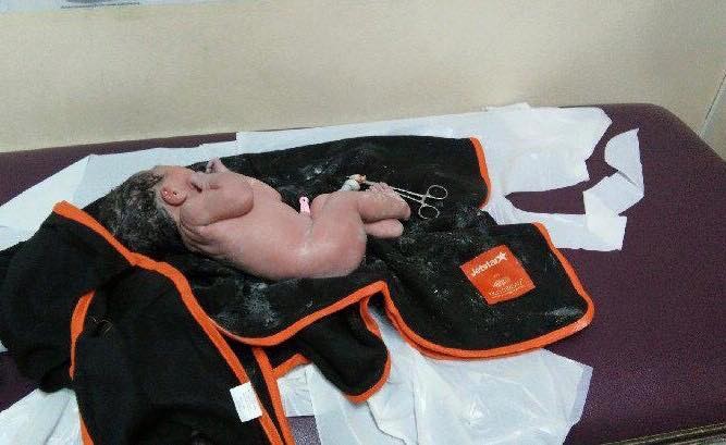 Saw, logo depois de nascer (Foto: Reprodução - Facebook)