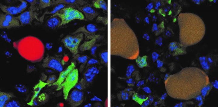Células de câncer de mama em novo tratamento (Foto: Department of Biomedicine, University of Basel)