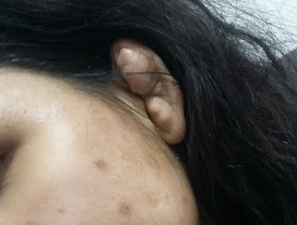 Denunciante afirmou à polícia que orelhas de jovem ficou deformada por causa de facada (Foto: Maiara Barbosa/G1)