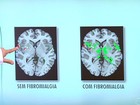 Exercício físico ajuda a diminuir dor no corpo causada pela fibromialgia