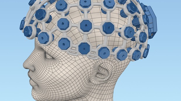 Startup quer individualizar exames de eletroencefalograma (EEG) (Foto: Divulgação)