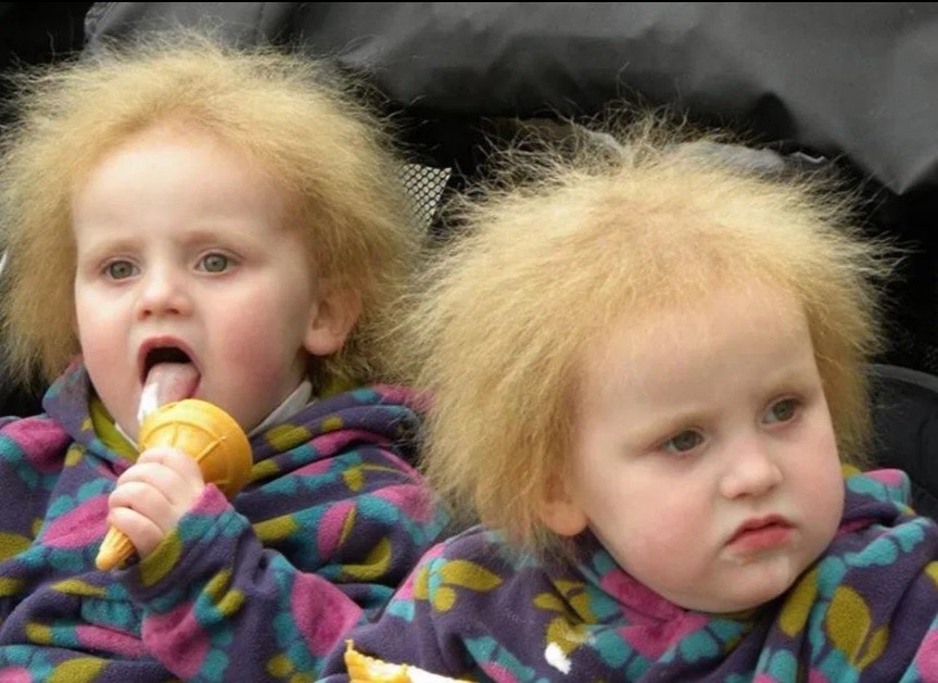 As gêmeas Agnetha e Anja quando bebês (Foto: Arquivo pessoal)