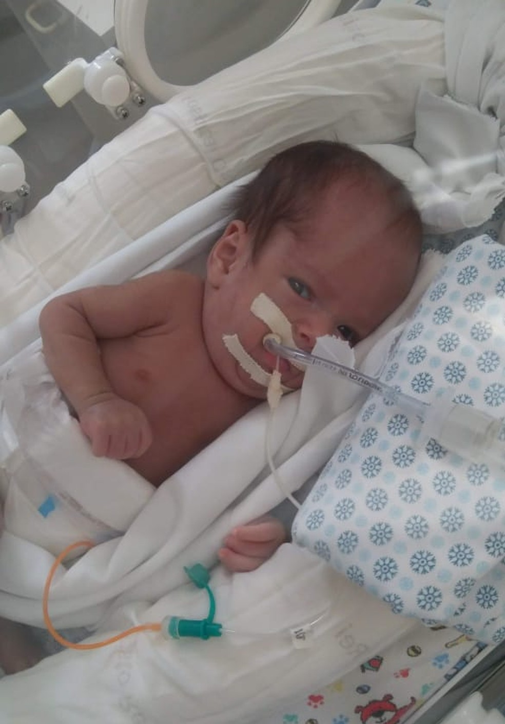 Felipe nasceu prematuro e teve complicações — Foto: ARquivo Pessoal