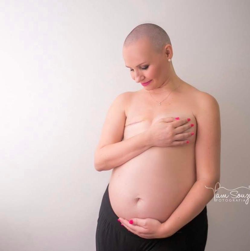 Beatriz após cirurgia para retirada da mama (Foto: Arquivo Pessoal)
