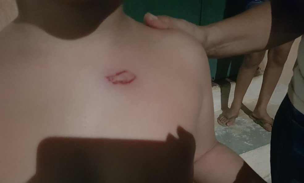 Criança de seis anos foi atingida no peito após assalto em Fortaleza. — Foto: Rafaela Duarte