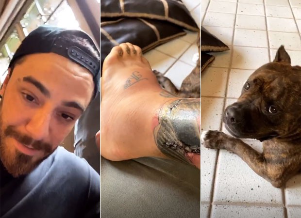 Felipe Titto mostra perna inchada por causa de infecção após mordida de cachorro  (Foto: Reprodução)