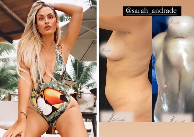 Veja o antes e depois dos procedimentos estéticos de Sarah Andrade (Foto: Reprodução/Instagram)