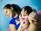 PE tem diagnóstico de microcefalia confirmado em quase 400 bebês