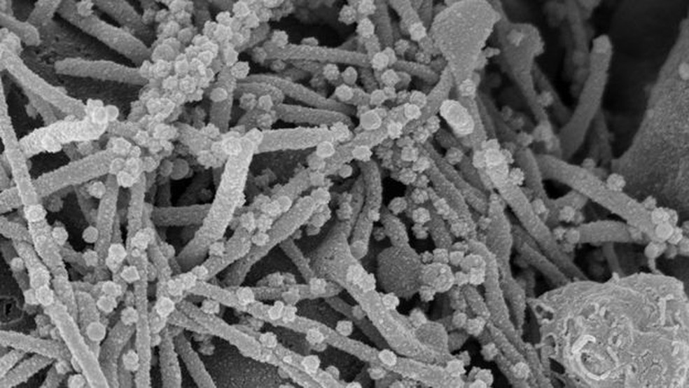 O vírus usa os filopódios para sair da célula infectada e infectar outras células próximas — Foto: Elizabeth Fischer/Microscopy Unit NIH/NIAID/BBC