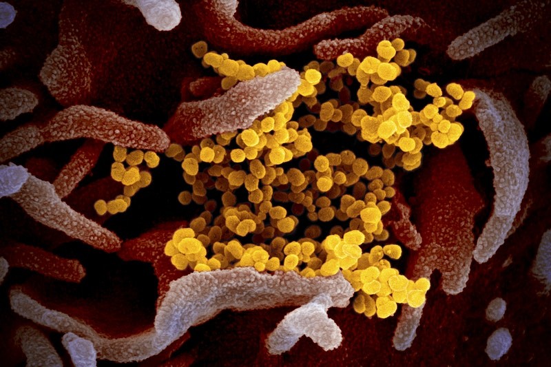 Novo coronavírus afeta sistema respiratório (Foto: Creative commons)