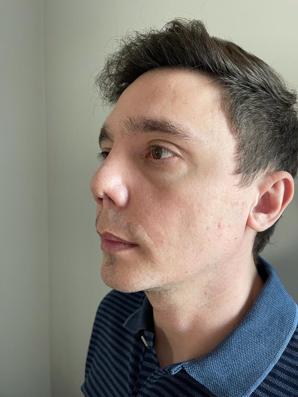 Veraldino de Freitas Júnior foi um dos pacientes do dr. Alan Landecker — Foto: Arquivo Pessoal