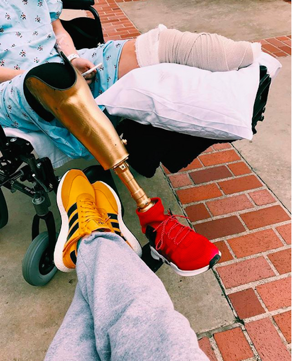 A modelo Lauren Wasser após amputar sua perna esquerda em foto compartilhada por sua namorada fotógrafa (Foto: Instagram)