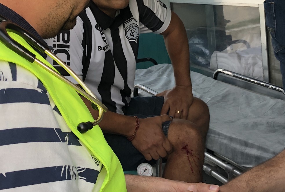 Torcedor teve a perna cortada (Foto: Lucas Barros / TV Cabo Branco)