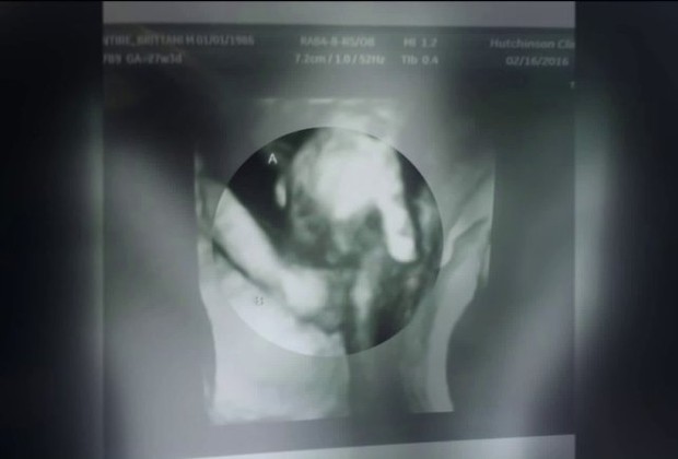 Os gêmeos aparecem de mãos dadas no ultrassom (Foto: Reprodução/ Fox8)