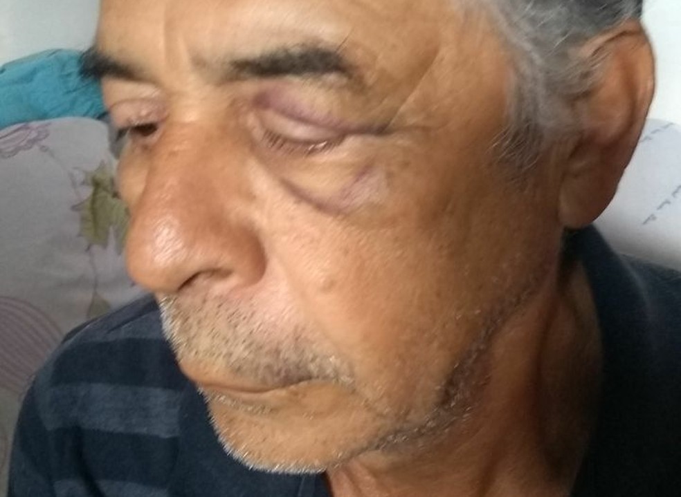 Idoso de 67 anos agredido por policial militar em CeilÃ¢ndia, no DF (Foto: Arquivo pessoal)