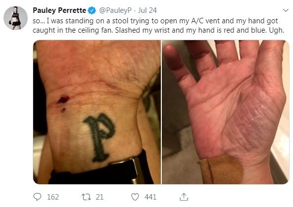 Pauley Perrette postou no Twitter fotos de machucados (Foto: Reprodução / Twitter)