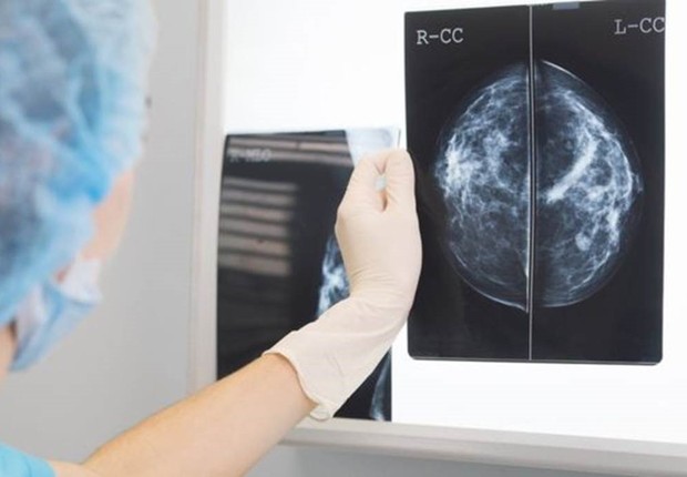 BBC News Brasil: Inteligência artificial bate médicos em diagnósticos de câncer de mama (Foto: GETTY IMAGES VIA BBC )