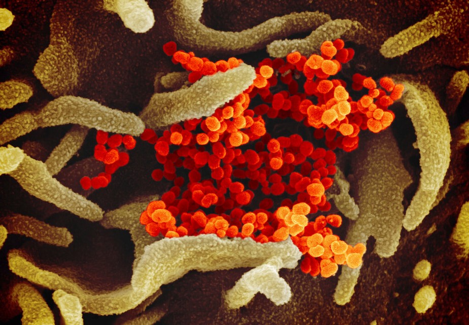 Imagem de laboratório do coronavírus atacando células de um paciente americano, fornecida pelo National Institute of Allergy and Infectious Diseases (NIAID), de Maryland (EUA)