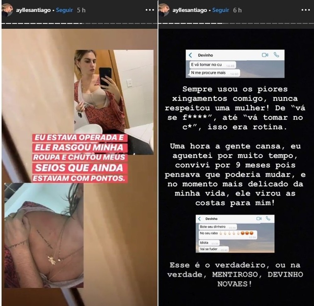 Cantor Devinho Novaes tem shows no São João cancelados na BA após ser acusado de agressão por ex-namorada 7