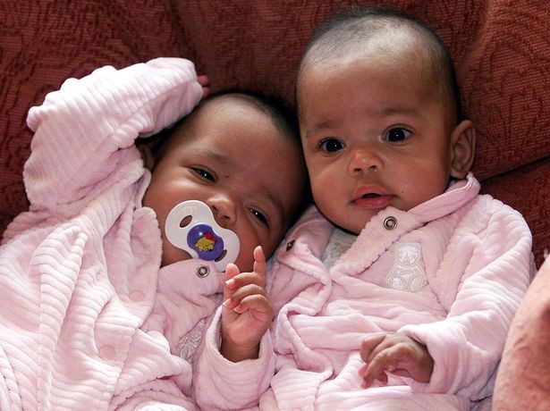 As gêmeas Kiara e Keyara quando bebês (Foto: Arquivo pessoal)