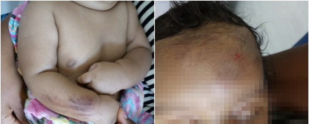 Bebê foi agredido pelo pai em Palmeirais — Foto: Divulgação/PC-PI
