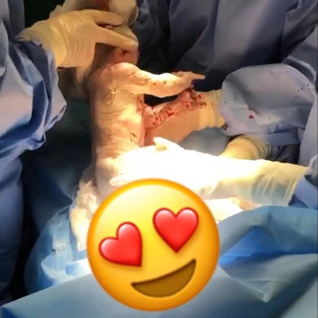   Dany Bananinha posta vídeo do nascimento de  Lara (Foto: Reprodução/Instagram )