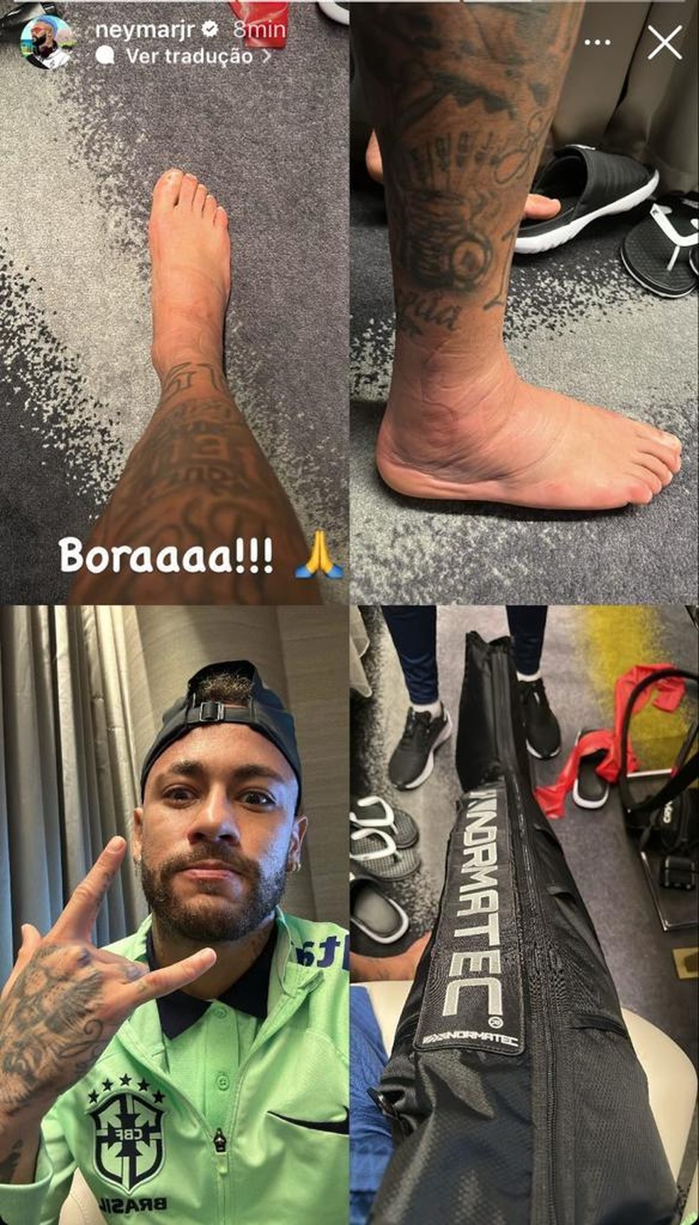 Neymar postou um compilado de fotos mostrando seu tratamento — Foto: Reprodução/Instagram