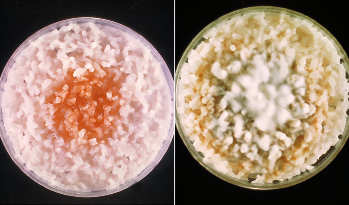 Fungo Africano E Reportado Pela 1ª Vez No Brasil Em 2 Criancas No Rio Bem Estar G1