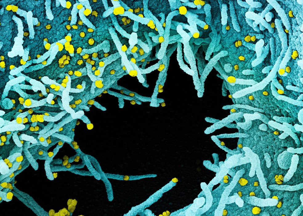 Micrografia eletrônica de uma célula infectada por partículas do SARS-CoV-2 (amarelo). A área preta é espaço extracelular entre as células. — Foto: Integrated Research Facility (IRF)/NIAID