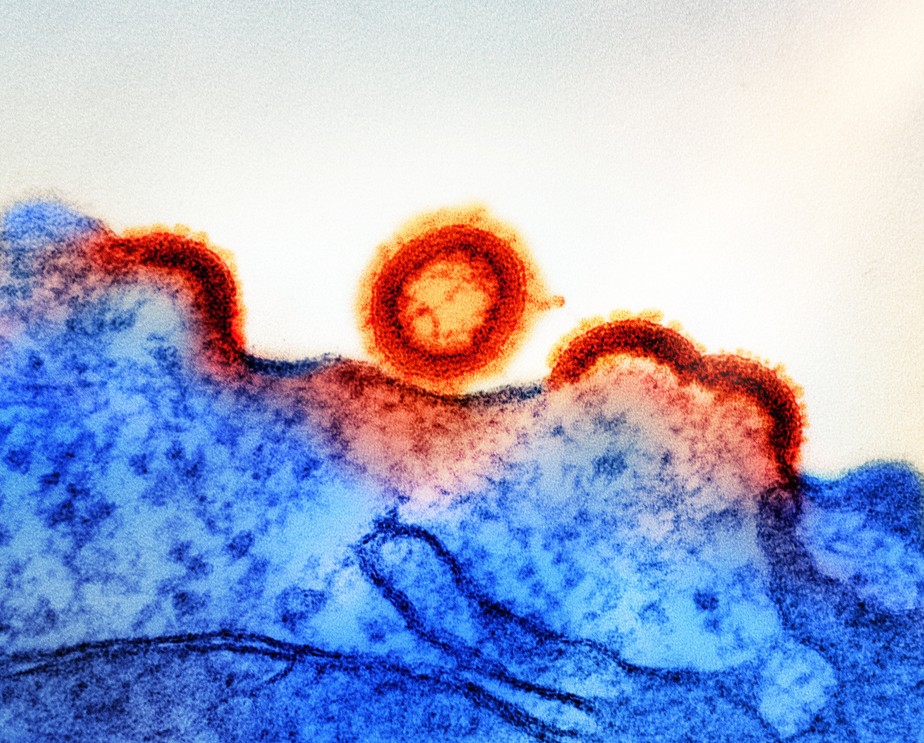 Partícula do HIV (em amarelo e vermelho) e uma célula infectada (em azul).