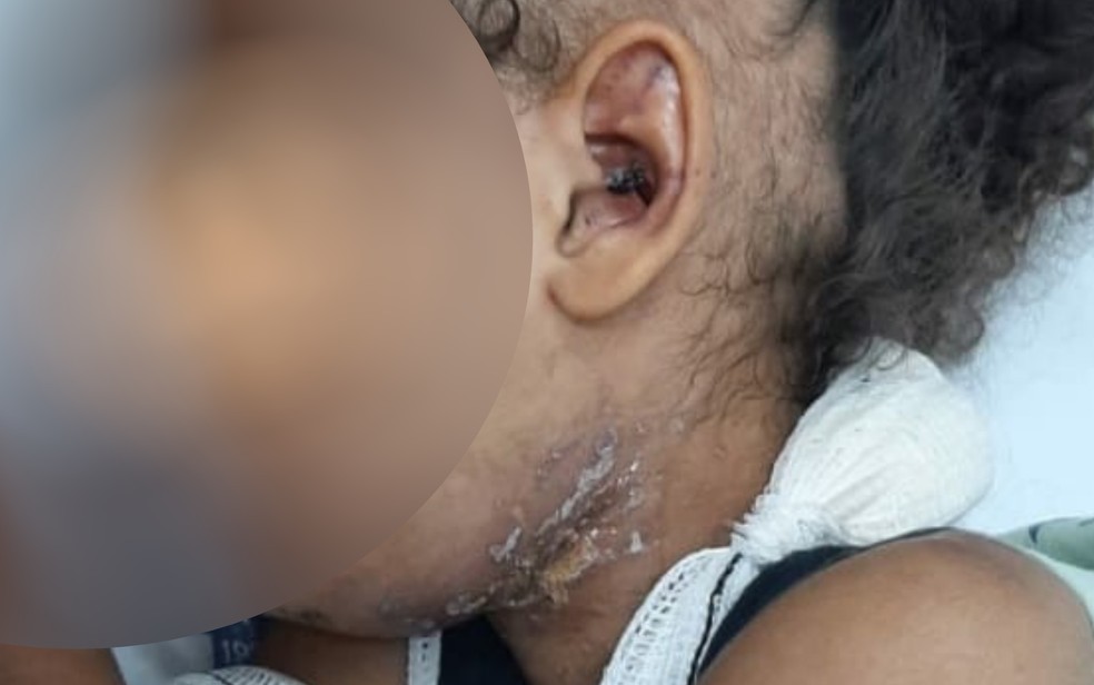 Menina de 4 anos estava muito machucada e teve que ser atendida em hospital — Foto: Reprodução/TV Anhanguera