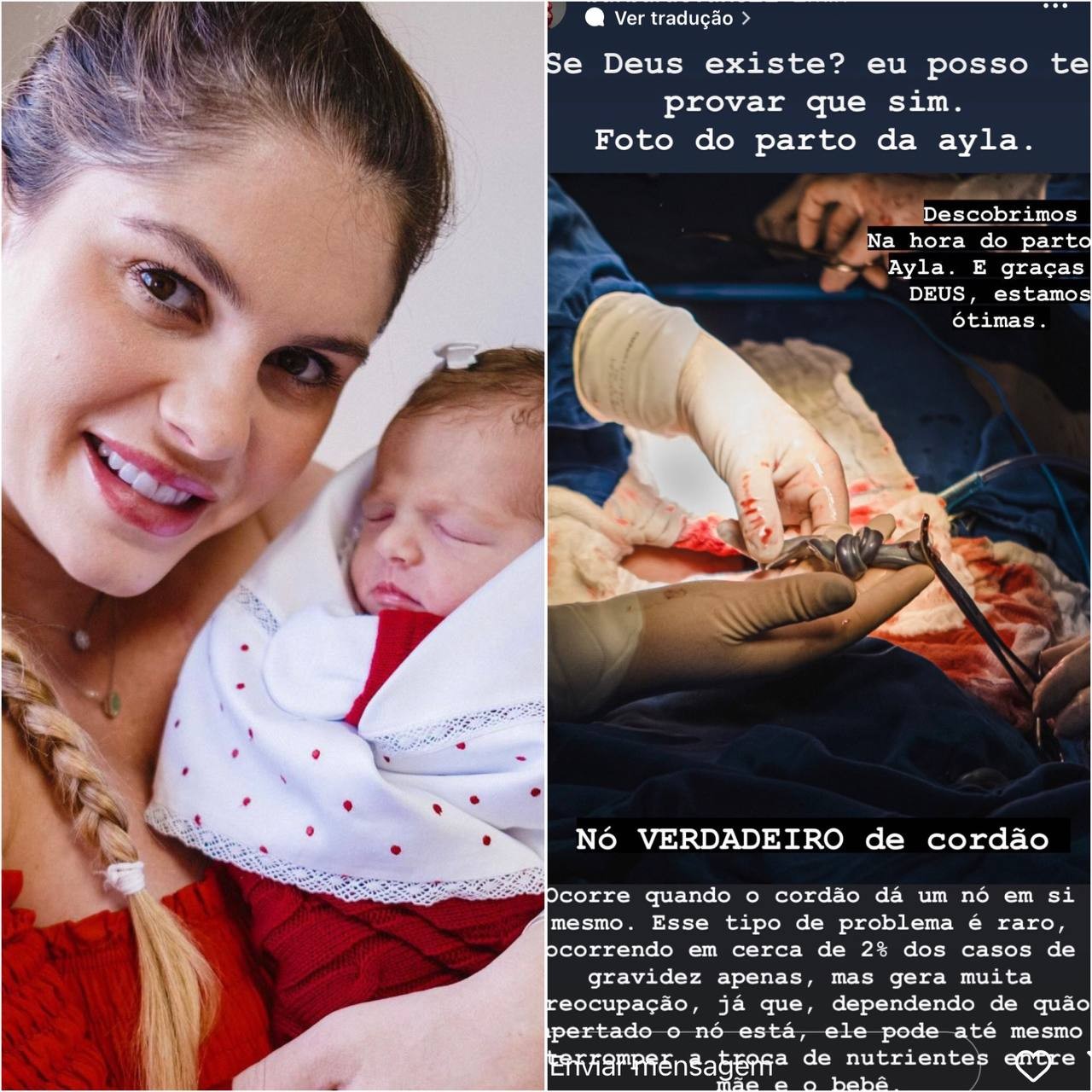 Bárbara Evans fala sobre problema raro descoberto durante parto de Ayla (Foto: Reprodução / Instagram)