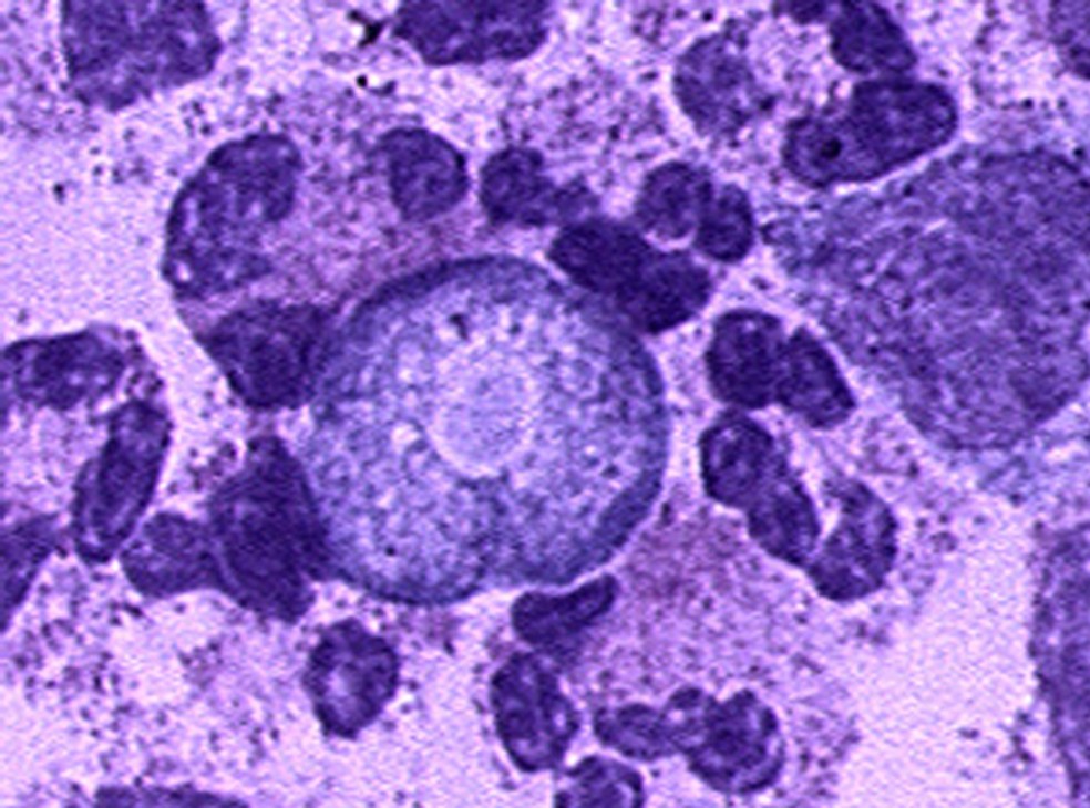 Meningoencefalite amebiana primária tem alto índice de letalidade — Foto: Laboratory Identification of Parasites of Public Health Concern/Divulgação