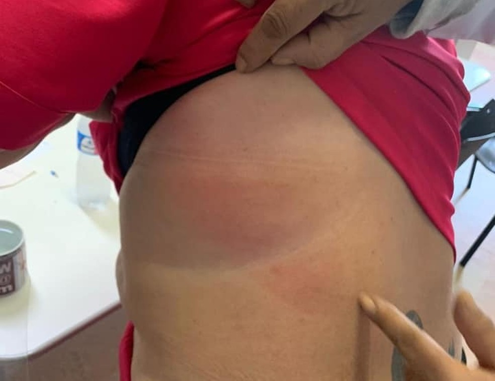 Médica denuncia agressão de marido de paciente em hospital de Pelotas — Foto: Arquivo Pessoal